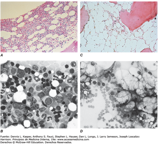 APLASIA