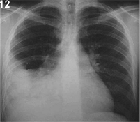 signo de la siluetam